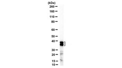 MilliporeSigma SET (I2PP2A), NT, Mouse, Unlabeled, Clone: 10E7, 100 &mu;g | Buy Online | MilliporeSigma&trade; | Fisher Scientific